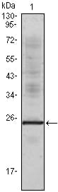 Figure 1: Western blot analysis using IL1a mouse mAb against truncated IL1a recombinant protein.