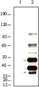 Figure 1: Western blot analysis using KSHV K8? mouse mAb against BCBL-1 (1) and TPA induced BCBL-1 (2) cell lysate.
