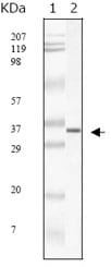 Figure 1: Western blot analysis using SARS-mpm mouse mAb against SARS-mpm recombinant protein.
