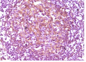 Figure 1: Immunohistochemical analysis of paraffin-embedded human lymphnode, showing membrane localization using CD14 mouse mAb with DAB staining.