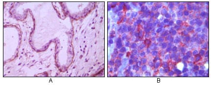 Figure 1: Immunohistochemical analysis of paraffin-embedded human breast ductal myoepithelium (A) and lymph tissue (B), showing cytoplasmic (A) and membrane (B) localization using CD10 mouse mAb with DAB staining (A) and AEC staining (B).