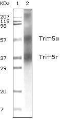 Figure 1: Western blot analysis using Trim5? mouse mAb against human breast carcinoma tissue lysate.