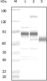 Figure 1: Western blot analysis using anti-KSHV ORF8 polyclonal antiobdy against uninduced BCBL1 cell lysate (1), TPA induced BCBL1 cell lysate(2) and purified virion (3).