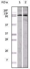 Figure 1: Western blot analysis using EphA1 mouse mAb against A549 (1) and Hela (2) cell lysate.