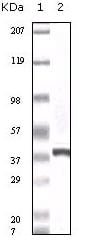 Figure 1: Western blot analysis using calcyclin mouse mAb against truncated calcyclin recombinant protein.