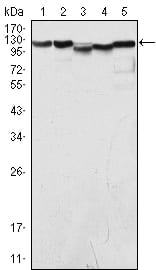 Figure 1: Western blot analysis using LSD1 mouse mAb against COS (1), Hela (2), NIH/3T3 (3), A549 (4) and Jurkat (5) cell lysate.