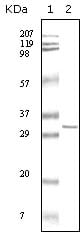 Figure 1: Western blot analysis using HPTR mouse mAb against truncated HPRT recombinant protein.