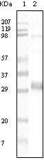 Figure 1: Western blot analysis using NPT mouse mAb against truncated NPT recombinant protein.