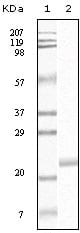 Figure 1: Western blot analysis using EphB4 mouse mAb against truncated EphB4 recombinant protein.