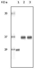 Figure 1: Western blot analysis using SRA mouse mAb against truncated SRA recombinant protein (1), human ovary cancer tissue lysate (2) and A431 cell lysate (3).