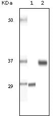 Figure 1: Western blot analysis using SRA mouse mAb against truncated SRA recombinant protein (1) and human ovary cancer tissue lysate (2).