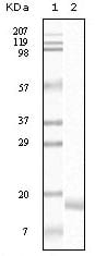 Figure 1: Western blot analysis using SNCA mouse mAb against truncated SNCA recombinant protein.