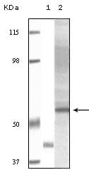 Figure 1: Western blot analysis using Akt3 mouse mAb against truncated Akt3 recombinant protein (1) and human ovary carcinoma tissue lysate (2).