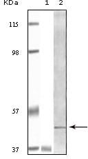 Figure 1: Western blot analysis using BLK mouse mAb against truncated BLK recombinant protein Raji cell lysate.