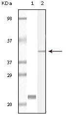 Figure 1: Western blot analysis using CIB1 mouse mAb against truncated CIB1 recombinant protein (1) and A431 cell lysate (2).