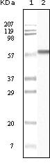 Figure 1: Western blot analysis using CK1 mouse mAb against truncated CK1 recombinant protein.