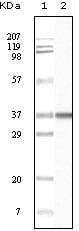 Figure 1: Western blot analysis using BLK mouse mAb against truncated BLK recombinant protein.