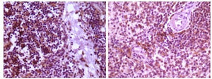 Figure 1: Immunohistochemical analysis of paraffin-embedded human thymoma tissue (left) and spleen tissue (right), showing cytoplasmic localization using MAP2K4 mouse mAb with DAB staining.