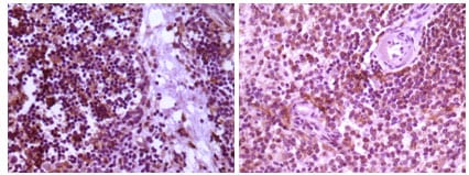 Figure 1: Immunohistochemical analysis of paraffin-embedded human thymoma tissue (left) and spleen tissue (right), showing cytoplasmic localization using MAP2K4 mouse mAb with DAB staining.