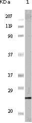 Figure 1: Western blot analysis using PR mouse mAb against PR recombinant protein (1).