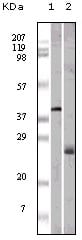 Figure 1: Western blot analysis using ApoM mouse mAb against GST-ApoM recombinant protein (1) and human serum (2).