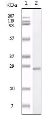 Figure 1: Western blot analysis using S100A mouse mAb against truncated S100A recombinant protein.