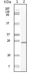 Figure 1: Western blot analysis using C-kit mouse mAb against truncated C-kit recombinant protein.