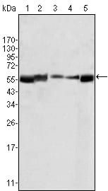 Figure 1: Western blot analysis using LYN mouse mAb agains HL60 (1), L540 (2), SLLP-M2 (3), SEM (4) and Ramos (5) cell lysate.