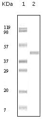 Figure 1: Western blot analysis using ABL2 mouse mAb against truncated ABL2 recombinant protein.