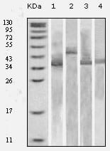 Figure 1: Western blot analysis using Trx mouse mAb against various fusion protein with Trx tag.