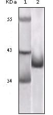 Figure 1: Western blot analysis using P16 mouse mAb against truncated P16 recombinant protein.