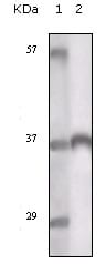 Figure 1: Western blot analysis using TYRO3 mouse mAb against truncated TYRO3 recombinant protein.