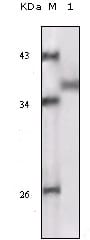 Figure 1: Western blot analysis using RSK1 mouse mAb against truncated RSK1 recombinant protein.