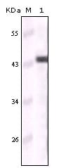 Figure 1: Western blot analysis using CK5 mouse mAb against truncated CK5 recombinant protein