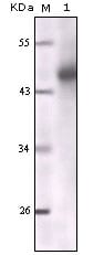 Figure 1: Western blot analysis using CK mouse mAb against truncated CK5 recombinant protein.