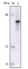 Figure 1: Western blot analysis using FES mouse mAb against truncated FES recombinant protein.
