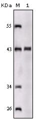 Figure 1: Western blot analysis using SORL1 mouse mAb against truncated SORL1 recombinant protein.