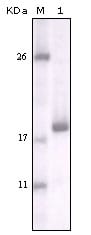 Figure 1: Western blot analysis using DDR2 mouse mAb against truncated DDR2 recombinant protein.