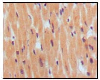 Figure 1: Immunohistochemical analysis of paraffin-embedded human normal myocardium, showing cytoplasmic localization using BNP1 mouse mAb with DAB staining.