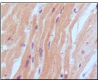 Figure 1: Immunohistochemical analysis of paraffin-embedded human normal myocardium, showing cytoplasmic localization using BNP2 mouse mAb with DAB staining.