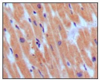 Figure 1: Immunohistochemical analysis of paraffin-embedded human normal myocardium, showing cytoplasmic localization using BNP3 mouse mAb with DAB staining.