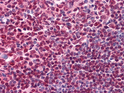 Figure 1: Immunohistochemical analysis of paraffin-embedded human Tonsil tissues using CD20 mouse mAb.