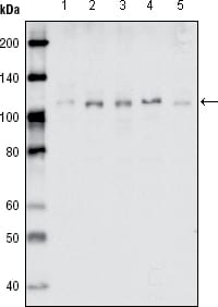 Figure 1: Western blot analysis using EhpB1 mouse mAb against MDA-MB-468 (1), MDA-MB-453 (2), MCF-7 (3), T47D (4) and SKBR-3 (5) cell lysate.