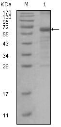 Figure 1: Western blot analysis using MSH6 mouse mAb against truncated MSH6 recombinant protein.
