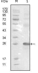 Figure 1: Western blot analysis using EphB3 mouse mAb against truncated EphB3-His recombinant protein.