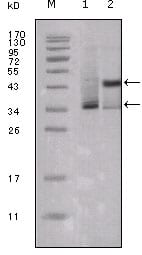 Figure 1: Western blot analysis using ESR1 mouse mAb against truncated ESR1-His recombinant protein (1) and truncated Trx-ESR1 recombinant protein (2).
