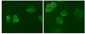 Figure 1: Immunofluorescence analysis of Hela (Left) and MCF-7 (Right) cells using Tyro3 mouse mAb (green).