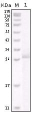 Figure 1: Western blot analysis using ERBB2 mouse mAb against truncated ERBB2 recombinant protein.