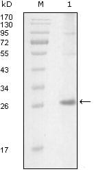 Figure 1: Western blot analysis using ITK mouse mAb against truncated Trx-ITK recombinant protein (1).