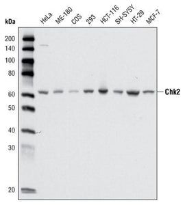 Figure 1: Western blot analysis using CHK2 mouse mAb against cell lysate from various cell types.